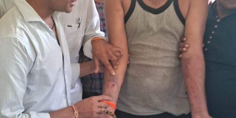 शर्मनाक : नैनीताल पुलिस की गुंडागर्दी, फेरीवाले का आधार कार्ड पूछने पर स्थानीय युवक को बुरी तरह पीटा