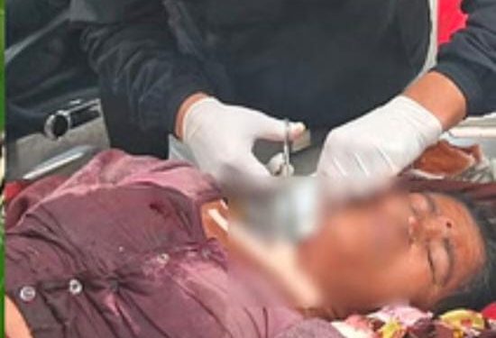 दहशत : गुलदार के हमले से महिला बुरी तरह घायल, अस्पताल में भर्ती