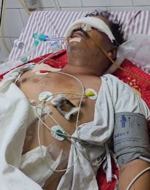 बदहाल सुशीला तिवारी अस्पताल : मरीज के बिस्तर पर रेंग रही चीटियां, आईसीयू वार्ड तक पहुंचे बंदर