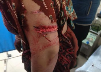 रुद्रप्रयाग ब्रेकिंग : अब यहां भालू के हमले में महिला गंभीर घायल