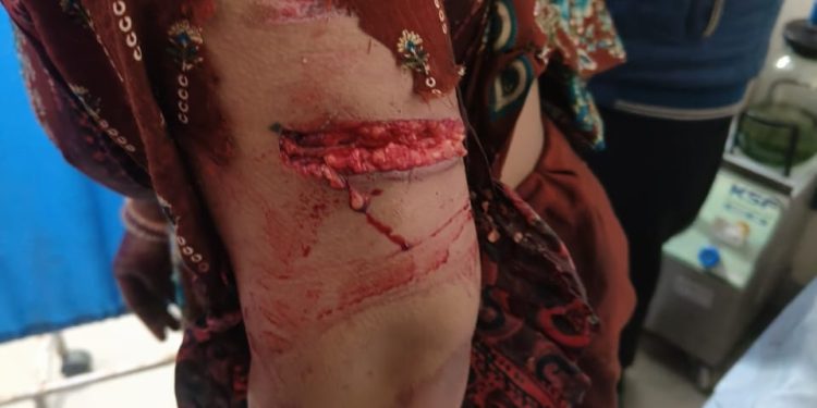 रुद्रप्रयाग ब्रेकिंग : अब यहां भालू के हमले में महिला गंभीर घायल