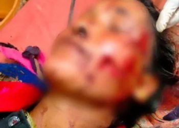 दहशत : अब यहां भालू के हमले में 64 वर्षीय महिला गंभीर घायल