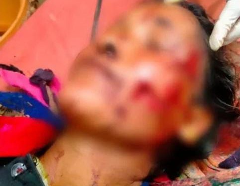 दहशत : अब यहां भालू के हमले में 64 वर्षीय महिला गंभीर घायल