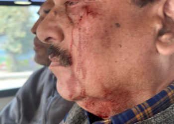 तानाशाही : अब भाजपा विधायक ने शिक्षा निदेशालय कार्यालय में शिक्षा निदेशक को पीटा, गंभीर घायल