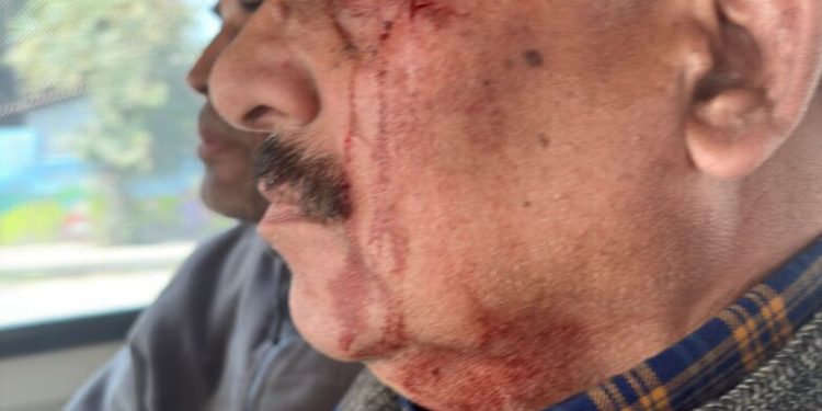 तानाशाही : अब भाजपा विधायक ने शिक्षा निदेशालय कार्यालय में शिक्षा निदेशक को पीटा, गंभीर घायल