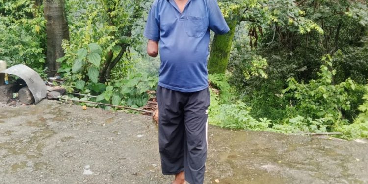 रुद्रप्रयाग : हाईटेंशन बिजली लाइन की चपेट में आने से हादसे में दोनों हाथ गंवाने वाले गरीब पिंकू को मिला इंसाफ, यूपीसीएल के एमडी पर मुकदमा दर्ज